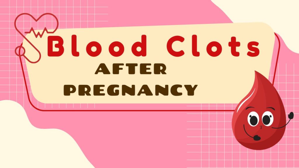 Blood Clots After Pregnancy